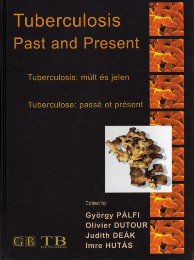 Knyv: Tuberculosis: Past and Present ( Gyrgy Plfi, Olivier Dutour, Judith Dek, Imre Huts ) - White Golden Book kiad - orvosi knyv, szakknyv, knyvkiads